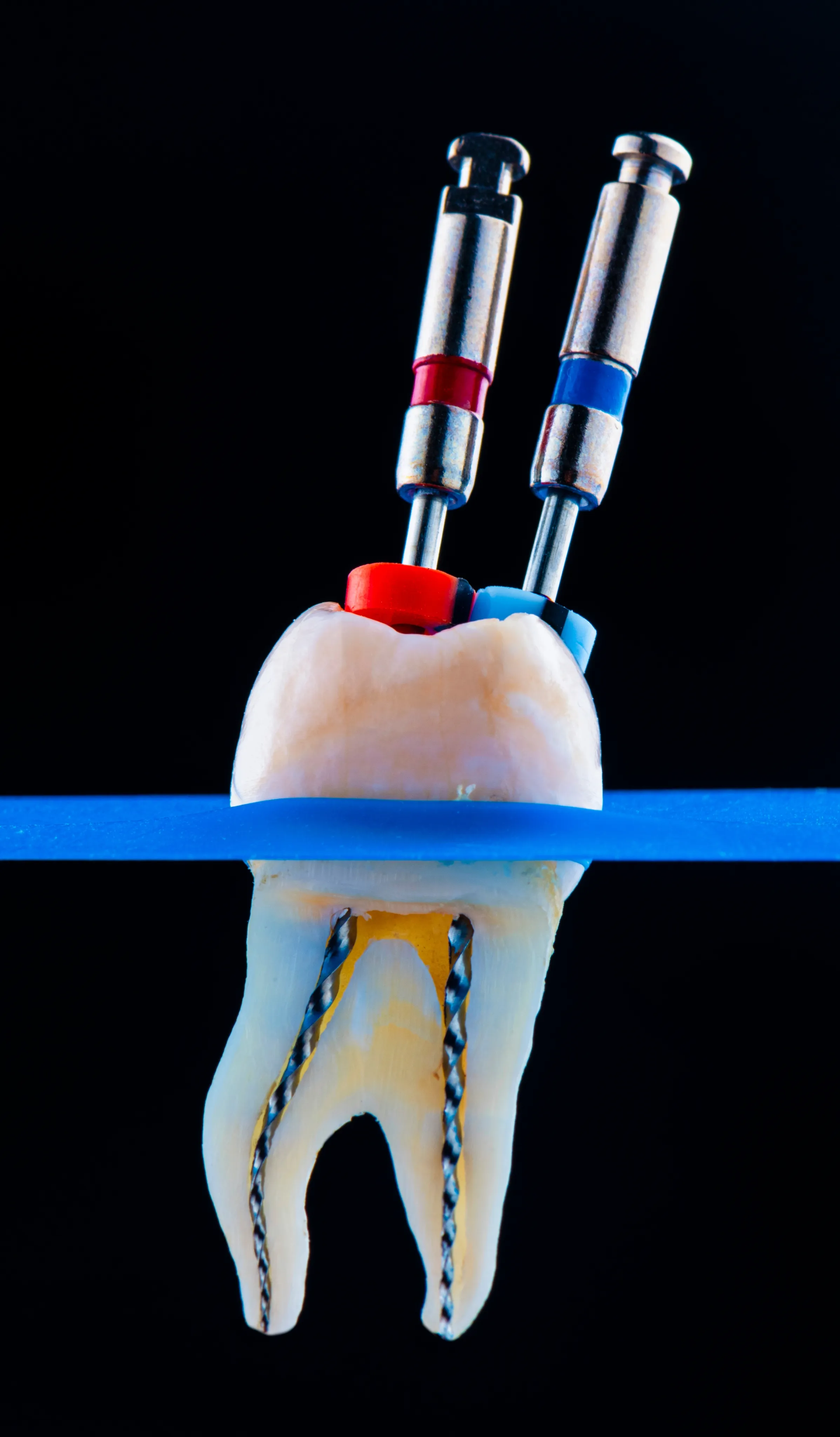 Save Your Tooth — Get Relief Today